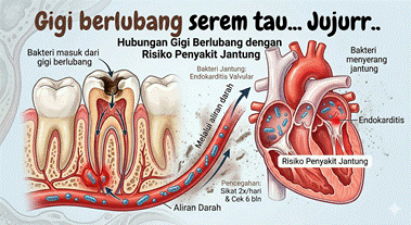 GIGI BERLUBANG ITU SEREM TAU JUJUR
